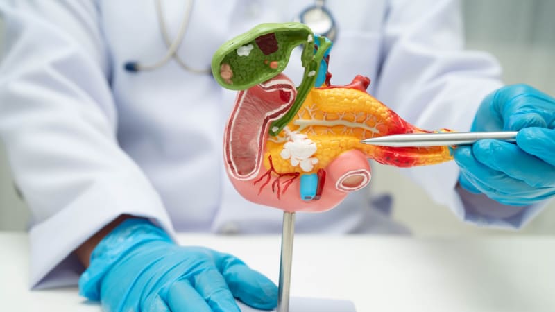 Převratný objev v boji s rakovinou slinivky: Nový lék dvojnásobně prodlužuje dožití